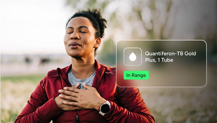 Test for tuberculosis&mdash;on your terms